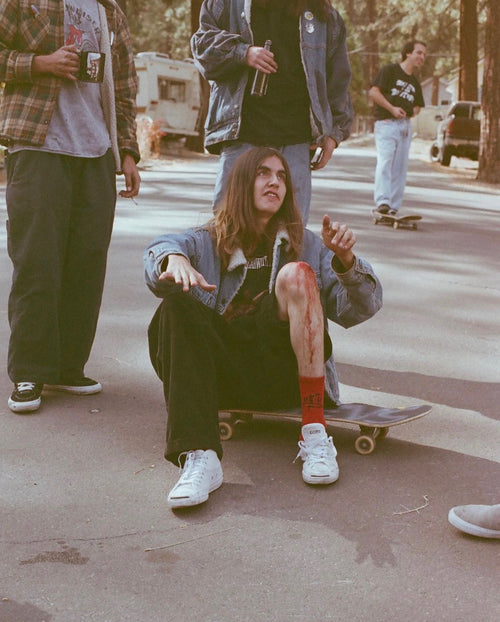 Adam Barragan sitting on his skateboard exposing his bloody knee while people stand around him